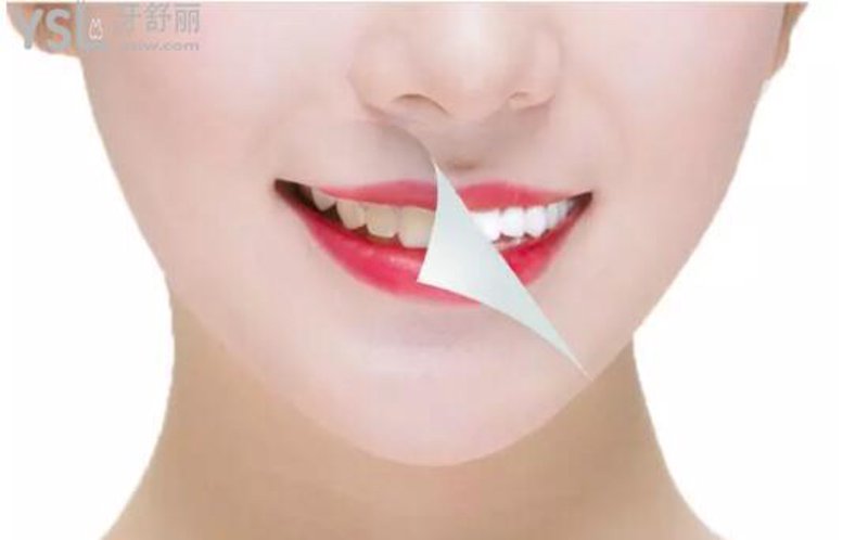 在选择适合自己的牙线时，你是否感到困惑？市场上琳琅满目的牙线品牌让人眼花缭乱。今天就让我们一起来看看几个主流品牌的优缺点吧。